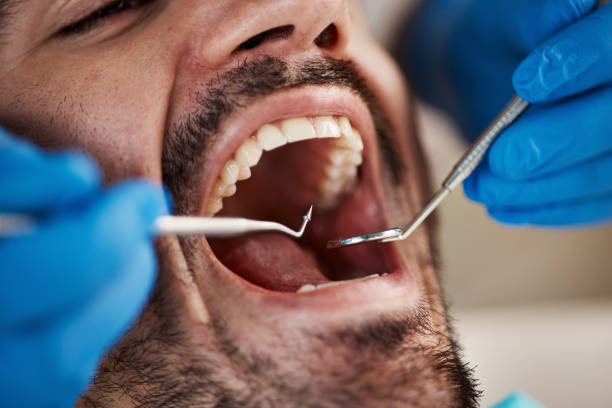 Best Pediatric Emergency Dentist in Danvle, IL