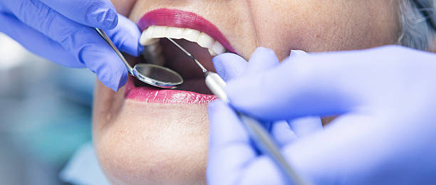 Best After-Hours Dental Trauma Care in Danvle, IL